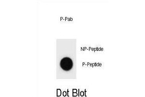 Dot blot analysis of CCNB3 Antibody (Phospho ) Phospho-specific Pab (ABIN1881173 and ABIN2839952) on nitrocellulose membrane.