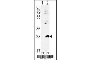 Western blot analysis of AK1 using rabbit polyclonal AK1 Antibody (S45) using 293 cell lysates (2 ug/lane) either nontransfected (Lane 1) or transiently transfected (Lane 2) with the AK1 gene. (Adenylate Kinase 1 antibody  (N-Term))