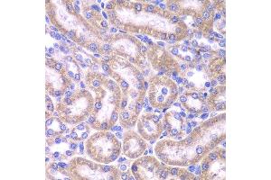 Immunohistochemistry (Paraffin-embedded Sections) (IHC (p)) image for anti-Fas (TNFRSF6)-Associated Via Death Domain (FADD) (AA 1-208) antibody (ABIN6140432)