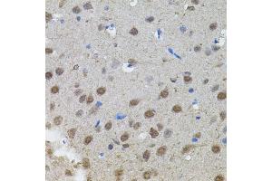 Immunohistochemistry of paraffin-embedded rat brain using MYCN antibody (ABIN5970179) (40x lens). (MYCN antibody)