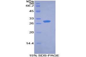 SDS-PAGE analysis of Mouse PDK1 Protein. (PDK1 Protein)