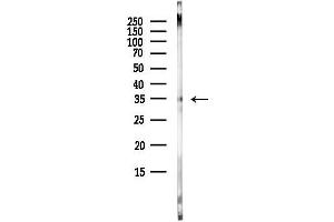 anti-Solute Carrier Family 25, Member 28 (SLC25A28) antibody