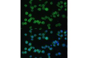 Immunofluorescence analysis of THP-1 cells using CD35/CD35/CR1 antibody (ABIN6130075, ABIN6138990, ABIN6138991 and ABIN6214176) at dilution of 1:100. (CD35 antibody  (AA 420-550))