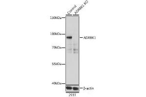 Western blot analysis of extracts from normal (control) and ADRBK1 knockout (KO) 293T cells using ADRBK1 Polyclonal Antibody at dilution of 1:500. (GRK2 antibody)