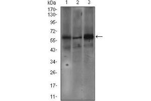 Western Blotting (WB) image for anti-Fc Fragment of IgE Receptor Ia (FCER1A) (AA 42-103) antibody (ABIN1845339) (Fc epsilon RI/FCER1A antibody  (AA 42-103))