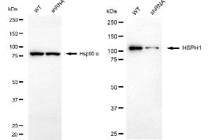 Western blotting analysis using HSPH1 antibody (ABIN7798840).