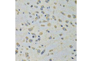 Immunohistochemistry of paraffin-embedded rat brain using DARS antibody. (DARS antibody  (AA 222-501))