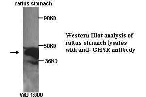 Image no. 1 for anti-Growth Hormone Secretagogue Receptor (GHSR) (C-Term) antibody (ABIN790871)