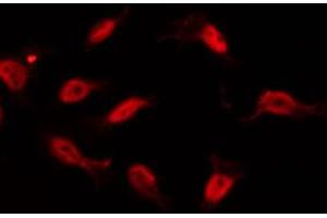 ABIN6266959 staining 293 by IF/ICC. (TAF6L antibody  (N-Term))