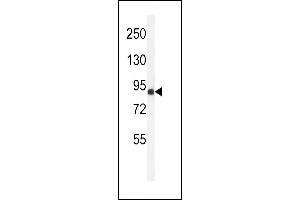 Western blot analysis of ANR49 Antibody (Center) (ABIN651157 and ABIN2840103) in Jurkat cell line lysates (35 μg/lane). (ANKRD49 antibody  (AA 80-109))