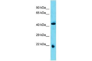 Host: Rabbit  Target Name: Abhd4  Sample Tissue: Rat Pancreas lysates  Antibody Dilution: 1. (ABHD4 antibody  (N-Term))