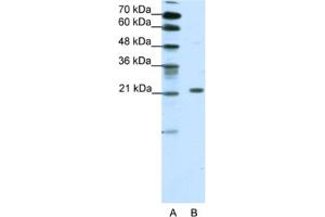 Western Blotting (WB) image for anti-Chromobox Homolog 1 (CBX1) antibody (ABIN2460949) (CBX1 antibody)