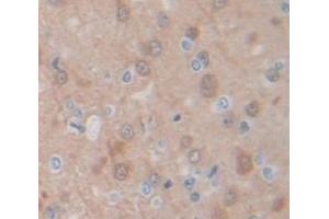 Figure. (SIRT6 antibody  (AA 88-288))