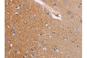 The image on the left is immunohistochemistry of paraffin-embedded Human brain tissue using ABIN7128771(CASC3 Antibody) at dilution 1/20, on the right is treated with fusion protein.