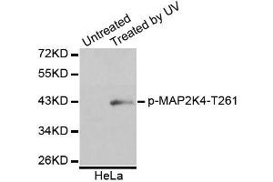 Western blot analysis of extracts of HeLa cells, using Phospho-MAP2K4-T261 antibody (ABIN5995644). (MAP2K4 antibody  (pThr261))