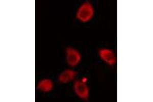 ABIN6274133 staining HeLa cells by IF/ICC. (ZNF265 antibody  (Internal Region))