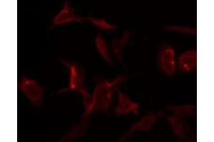 ABIN6266632 staining A549 by IF/ICC.