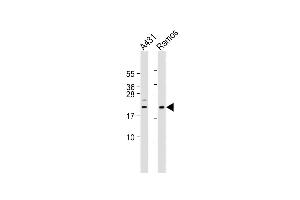 All lanes : Anti-hBik-BH3 at 1:2000 dilution Lane 1: A431 whole cell lysate Lane 2: Ramos whole cell lysate Lysates/proteins at 20 μg per lane. (BIK antibody  (AA 39-74))