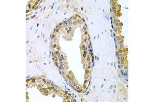 Immunohistochemistry of paraffin-embedded human prostate using TNFSF10 antibody (ABIN5971165) at dilution of 1/200 (40x lens). (TRAIL antibody)