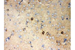 IHC-P: P2X5 antibody testing of mouse brain tissue (P2RX5 antibody  (AA 333-422))