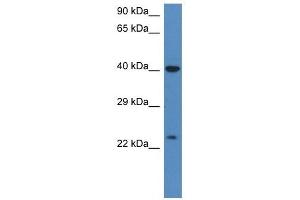 Western Blot showing PRSS1 antibody used at a concentration of 1 ug/ml against HT1080 Cell Lysate (PRSS1 antibody  (C-Term))