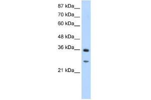 GIPC2 antibody used at 1. (GIPC2 antibody  (N-Term))