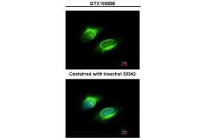 ICC/IF Image Immunofluorescence analysis of methanol-fixed HeLa, using PAPSS1, antibody at 1:200 dilution. (PAPSS1 antibody)