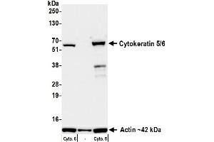 anti-Keratin 5/6 (KRT5/6) (C-Term) antibody