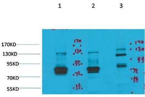 Western Blot (WB) analysis of 1) Rat Brain Tissue, 2)Mouse Brain Tissue , 3) HeLa with KV11. (KCNH7 antibody)