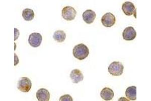 Western Blotting (WB) image for anti-DNA Fragmentation Factor, 45kDa, alpha Polypeptide (DFFA) (AA 313-331) antibody (ABIN189943)