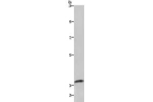 Gel: 6 % SDS-PAGE, Lysate: 40 μg, Lane: Mouse kidney tissue, Primary antibody: ABIN7129587(GDF3 Antibody) at dilution 1/250, Secondary antibody: Goat anti rabbit IgG at 1/8000 dilution, Exposure time: 1 minute (GDF3 antibody)
