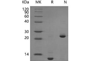 Western Blotting (WB) image for Transforming Growth Factor, beta 2 (TGFB2) (Active) protein (ABIN7320669) (TGFB2 Protein)