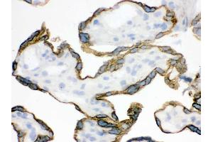 IHC analysis of ZP2 using anti-ZP2 antibody . (ZP2 antibody  (N-Term))