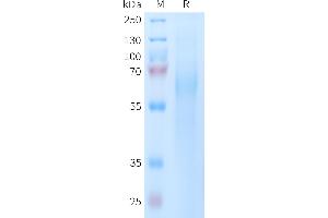 Human Protein, His Tag on SDS-PAGE under reducing condition.