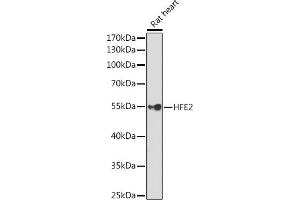 Western blot analysis of extracts of Rat heart, using HFE2 Rabbit pAb (ABIN6129023, ABIN6141738, ABIN6141739 and ABIN6220983) at 1:1000 dilution. (HFE2 antibody  (AA 1-174))