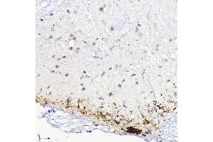 Immunohistochemistry of paraffin-embedded mouse spinal cord using CALCA Rabbit pAb (ABIN7266005) at dilution of 1:100 (40x lens). (CGRP antibody  (AA 1-141))