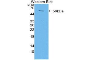 Western Blotting (WB) image for anti-Transmembrane Protein 27 (TMEM27) (AA 12-222) antibody (ABIN1871656) (TMEM27 antibody  (AA 12-222))