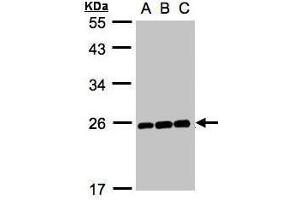 WB Image Sample (30μg whole cell lysate) A:Hep G2 , B:MOLT4 , C:Raji , 12% SDS PAGE antibody diluted at 1:1000 (MAD2L1 antibody  (C-Term))