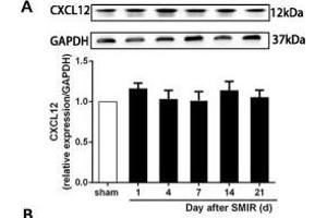 The CXCR7 and PI3K/Akt signaling pathways are involved in CPSP in the dorsal horn of the spinal cord. (GAPDH antibody)
