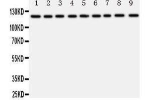 Western Blotting (WB) image for anti-Transient Receptor Potential Cation Channel, Subfamily C, Member 3 (TRPC3) (AA 836-851), (C-Term) antibody (ABIN3044145)