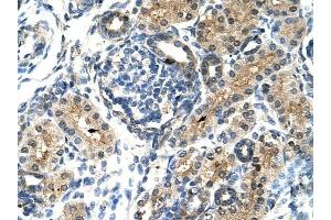TIMELESS antibody was used for immunohistochemistry at a concentration of 4-8 ug/ml to stain Epithelial cells of renal tubule (arrows) in Human Kidney.
