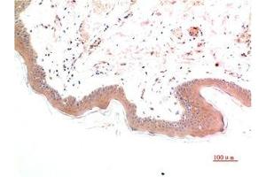 Immunohistochemical analysis of paraffin-embedded Human Skin Tissue using Phospho-Smad3(S425) Mouse mAb diluted at 1:200. (Phospho-SMAD3(S425) (pSer425) antibody)