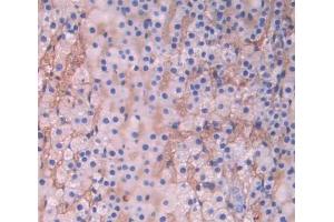 Used in DAB staining on fromalin fixed paraffin- embedded adrenal gland tissue (CYP17A1 antibody  (AA 183-508))