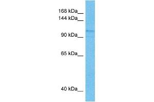 Host:  Mouse  Target Name:  SIN3B  Sample Tissue:  Mouse Spleen  Antibody Dilution:  1ug/ml (SIN3B antibody  (N-Term))