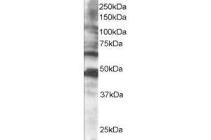 Image no. 1 for anti-Cytoplasmic Polyadenylation Element Binding Protein 1 (CPEB1) (C-Term) antibody (ABIN374439) (CPEB1 antibody  (C-Term))