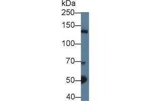 Western blot analysis of Mouse Cerebrum lysate, using Mouse HDAC4 Antibody (1 µg/ml) and HRP-conjugated Goat Anti-Rabbit antibody (