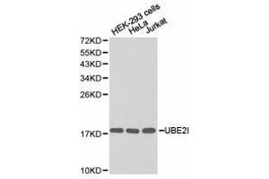 Western Blotting (WB) image for anti-Ubiquitin-Conjugating Enzyme E2I (UBE2I) antibody (ABIN1875255) (UBE2I antibody)