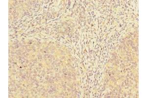Immunohistochemistry of paraffin-embedded human tonsil tissue using ABIN7173532 at dilution of 1:100 (ADAT1 antibody  (AA 1-501))