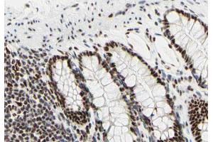 ABIN6266668 at 1/100 staining human colon tissue sections by IHC-P. (UBA2 antibody  (C-Term))