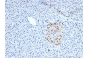 Immunohistochemistry (IHC) image for anti-NK6 Homeobox 1 (NKX6-1) antibody (ABIN6940213)